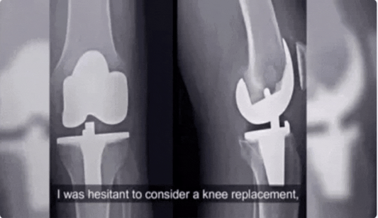 Knee Patches ( Pack of 10, 20, 30 )