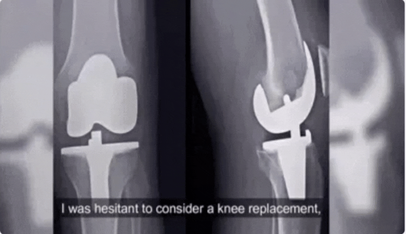 Knee Patches ( Pack of 10, 20, 30 )